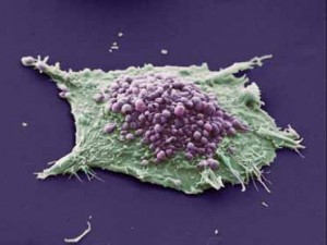 سلول هاي سرطاني،درمان سرطان