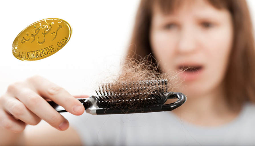 رایج ترین شکل ریزش موی زنان چیست -علت ریزش موی پشت سر زنان
