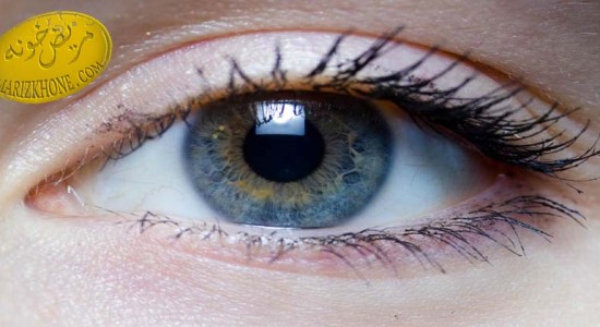 علل پرش پلک چشم و راه درمان آن-پرش پلک چشم-دکتر کی‌پور اپتومتریست-علت پرش پلک‌ها به مدت طولانی -اسپاسم عضلات چشم-درمان پرش پلک چشم