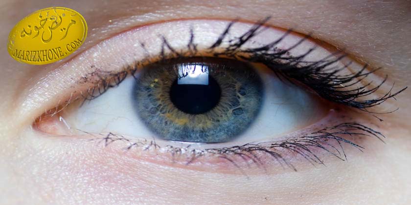علل پرش پلک چشم و راه درمان آن-پرش پلک چشم-دکتر کی‌پور اپتومتریست-علت پرش پلک‌ها به مدت طولانی -اسپاسم عضلات چشم-درمان پرش پلک چشم