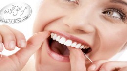 علت تغییر رنگ دندانها و روش هایی برای سفید کردن آنها -راه پیشگیری از تغییر رنگ دندانها-روش سفید کردن دندان ها-داروی آنتی بیوتیک تتراسایکلین-باندینگ دندان