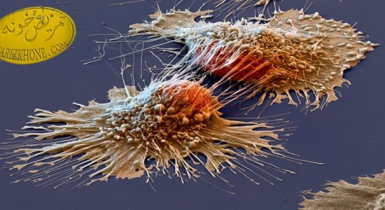 تشخیص سلول‌های سرطانی با نانو ذرات طلا ,رنگ سنجی نانو ذرات طلا,درمان سرطان,علت ابتلا به سرطان,انواع سرطان,درمان سرطان پوست,روش های تشخیص سرطان