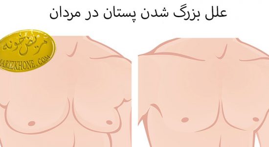 بزرگ شدن پستان در مردان
