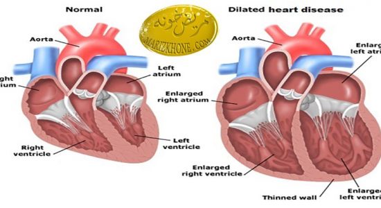 بیماریهای قلبی و علائم آن