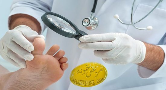 راههای درمان زخم پای دیابتی