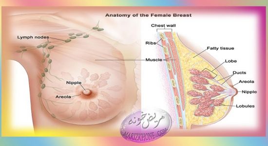 علائم سرطان سينه در زنان