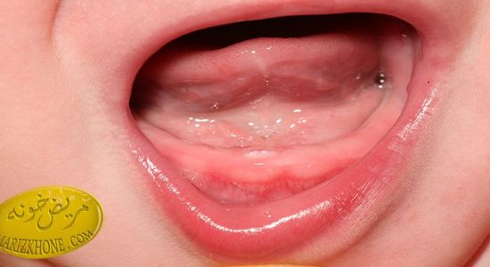 علائم رویش اولین دندان در نوزادان