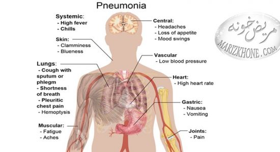 درمان پنومونی